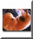 Human Embryo at 7 weeks