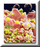 Scanning Electron Micrograph (SEM) of the surface of a T-Lymphocyte (pink) infected with HIV